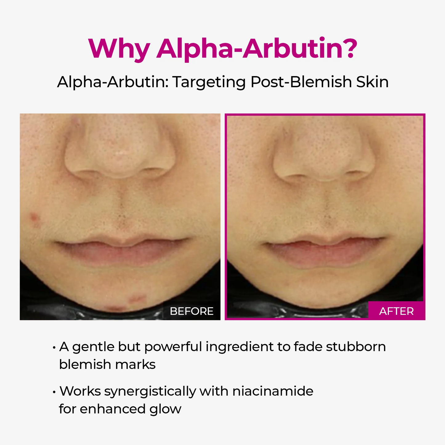 Lumi firm & lift Duo